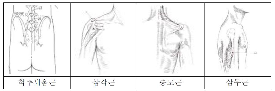 본 연구에서 평가된 근육과 근전도 부착 위치