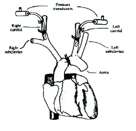 그림 2-12. 횡대동맥 결찰법
