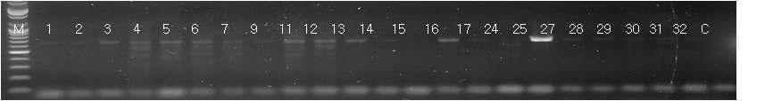 Hygromycin B 유전자 PCR.