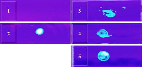 Fig. 11. UV photography showing β-linked type identificaion by Fungi-Fluor Kit