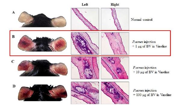 [그림 18. 여드름성 피부질환에 봉독의 효능 확인]