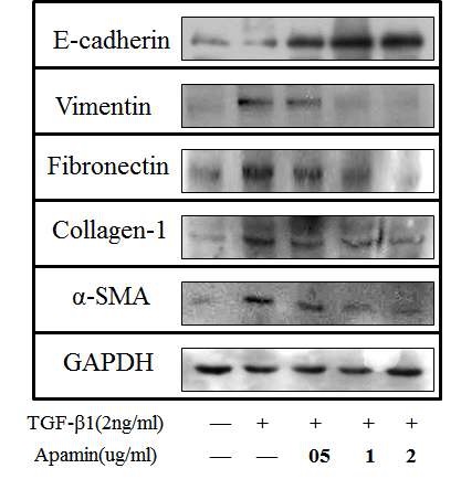 [그림 27. 간세포의 EMT과정에서 아파민 처리후 상피세포 및 중간엽세포 표지 단백질의 발현변화]