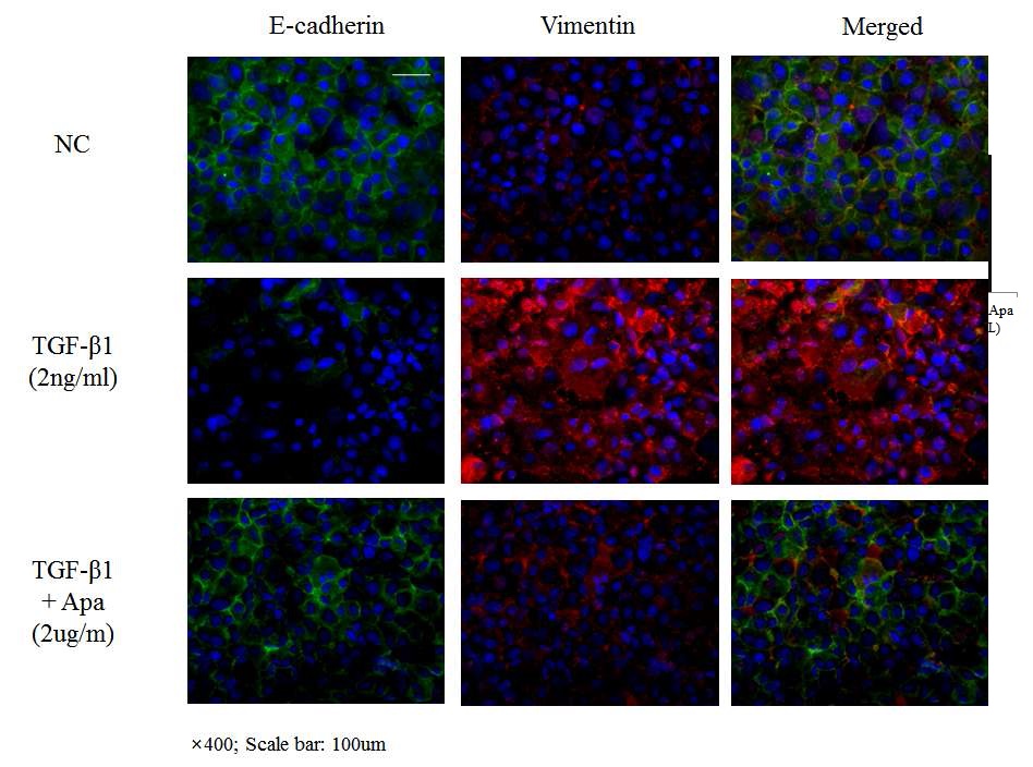 [그림 28. 간세포의 EMT과정에서 아파민 처리후 E-cadherin과 vimentin의 발현변화]