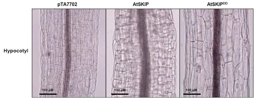 그림 11. pTA7702, AtSKIP 및 AtSKIPDD 형질전환체들 간의 hypocotyl 세포 크 기 비교 분석.