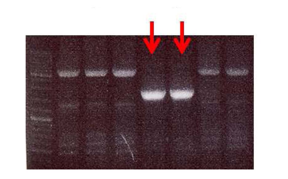 ICM in-frame deletion plasmid의 single-crossover mutant를 PCR로 확인