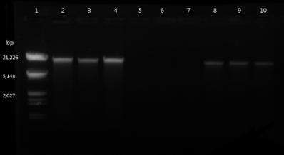 그림 2-2. 상업적 kit를 사용하여 분리된 DNA의 Agarose gel 전기영동 사진.