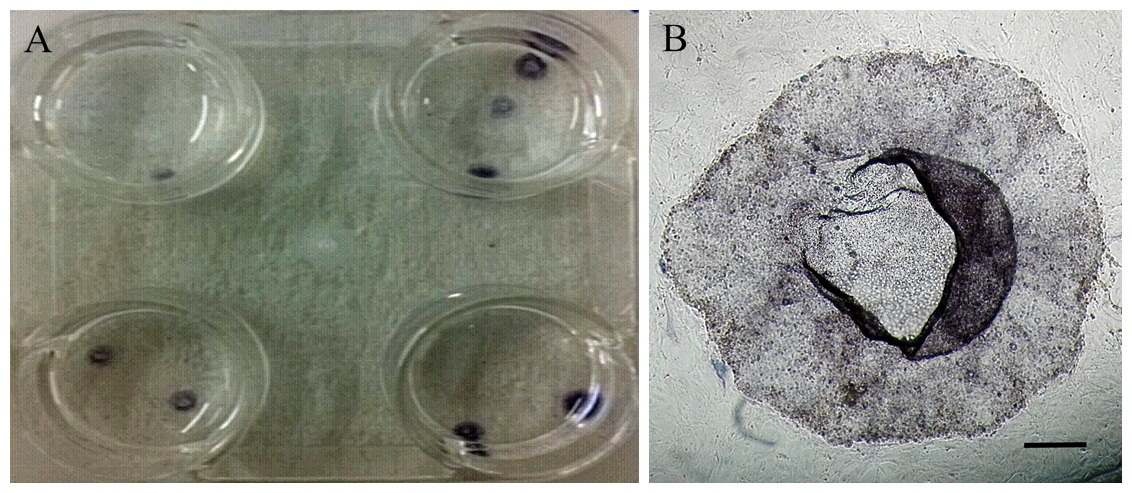그림 11. 배양 plate 내의 Alkaline phosphatase 양성이 확인된 소 핵 이식 유래 배아줄기세포 콜로니 (A) 및 확대사진 (B)