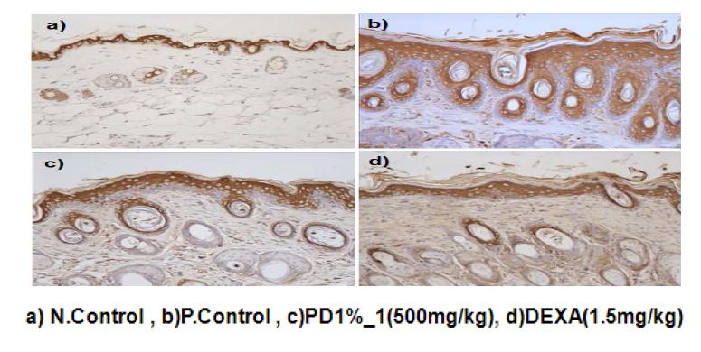 Fig9. Immunohistochemical finding for cytokeratin10 as a marker of differentiated keratinocyte