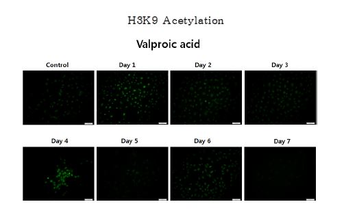 Figure. 1-3. 소 체세포에 small molecules를 처리한후 H3K9의 acetylation의 패턴 변화