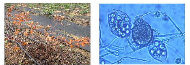 역병 병징과 Phytophthora sp. 유주자낭