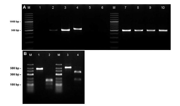 블루베리에 발생한 총채벌레의 PCR 기반 종동정