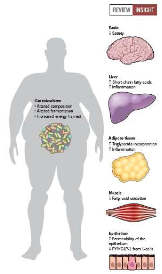 Microbiota와 비만과 인과관계