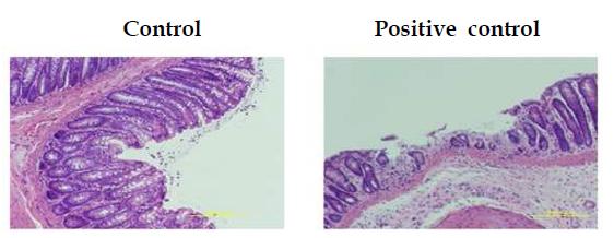 Histological observation of colonic lesions(H&E, x40)