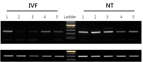 그림 44 WTA 방법으로 제작된 소 체외수정 배반포와 핵치환 배반포의 cDNA에서 PCR을 수행한 전기영동 사진
