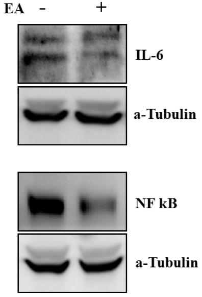 전침 처리에 의한 ALS 동물의 폐 조직에서 proinflammatory cytokine인 IL-6와 pNF-kB 변화