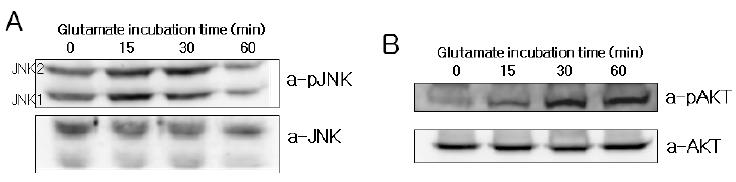 시간별 글루타민산에 의한 단백질의 변화