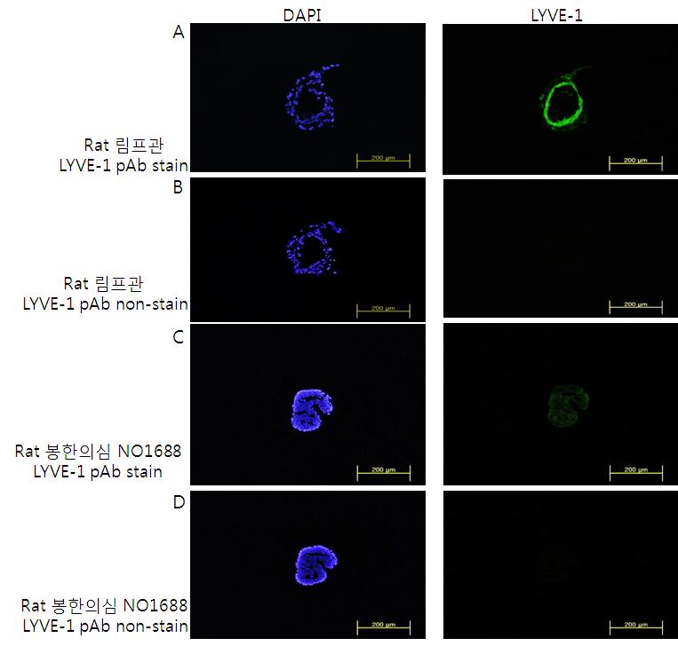 림프관과 봉한 의심 조직의 LYVE-1 면역형광염색 결과