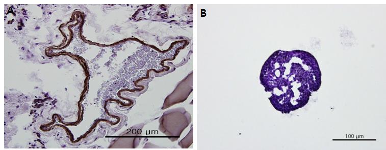 혈관과 봉한관의 α-SMA 면역염색 결과.