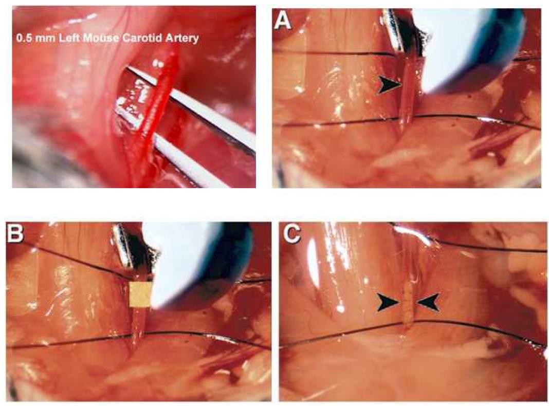 Animal model: FeCl3-induce Carotid artery thrombosis