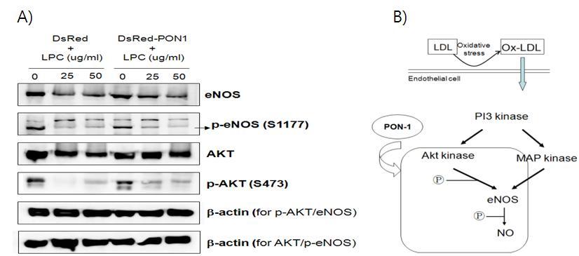 Recovery of p-eNOS and p-AKT expression, which were decreased on oxidative stress state, by PON1 overdepressive