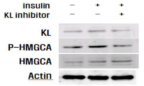 Different expression of phospho HMG CoA reductase on HepG2 cells by KL inhibitor, D-saccharic acid 1,4-lactone. Insuline and D-saccharic acid 1,4-lactone were treated at 1ug and 100uM, respectively, and expression of KL and p-HMGCR were detected by western blot. β-Actin was used as internal control