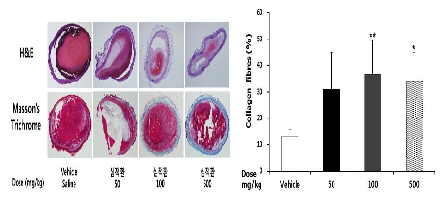 심적환의 농도에 대한 경동맥혈관손상 조직사진 및 손상 혈관내 콜라겐 정량