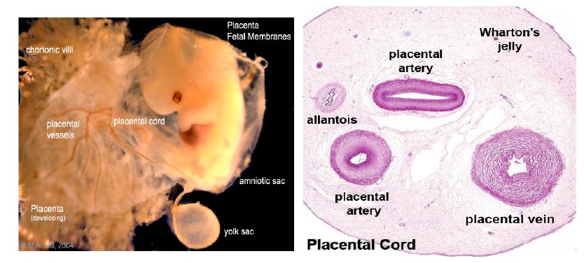 태반과 태아의 모습(좌)과 제대의 단면(우)