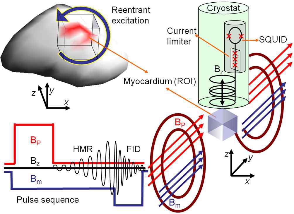 Schematic diagram of the heart magnetic resonance. Counterclockwise cyclic reentrant excitation on the myocardium generates oscillating magnetic fields around the region of interest (ROI). Once the corresponding Larmor frequency to the Bm static field is matched to the oscillating frequency, the magnetization that has been established by the Bp prepolarization field in the ROI begins tilting and the z-component of the magnetization precession get increased to generate Bz that can be detected by a SQUID sensor. To decouple the original reentry field detected by the SQUID sensor, the Bm is subjected to be changed non-adiabatically and the free induction decay can be measured at an arbitrary frequency with a narrow detection bandwidth.