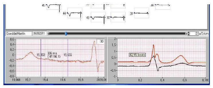 Signal processing window.