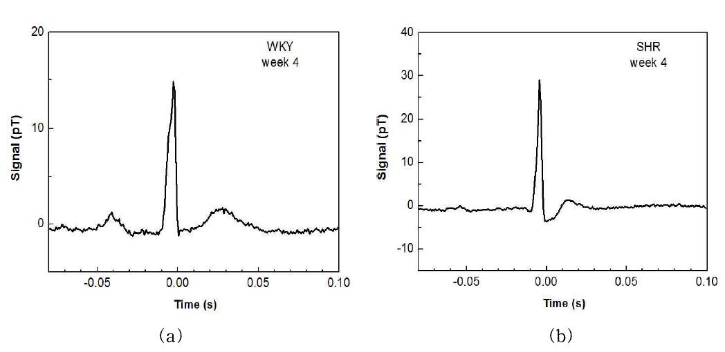 MCG waveforms at the age of 4-week for WKY (a) and SHR (b).