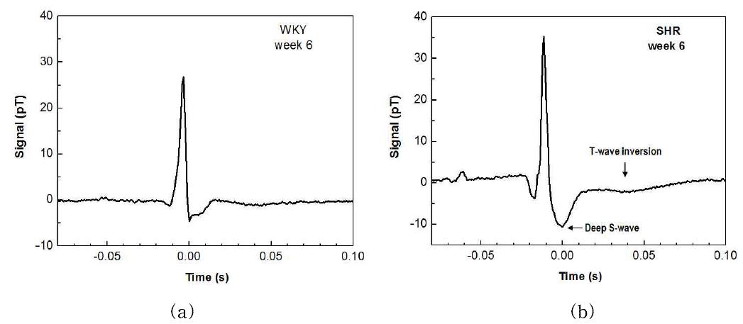 MCG waveforms at the age of 6-week for WKY (a) and SHR (b).