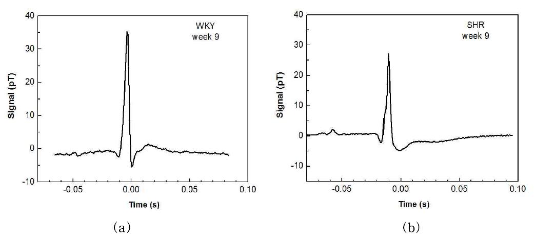 MCG waveforms at the age of 9-week for WKY (a) and SHR (b).