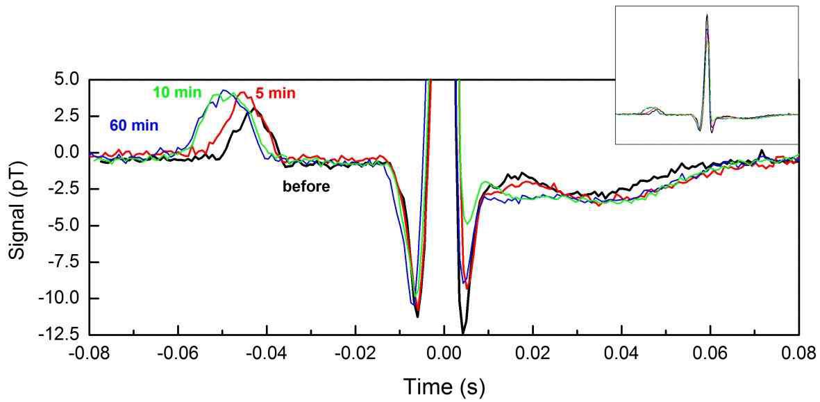 Temporal variations in the MCG waveform of normal rat(WKY) injected with magnetic nano-particle fluid. Inset shows normalized overall MCG waveforms.