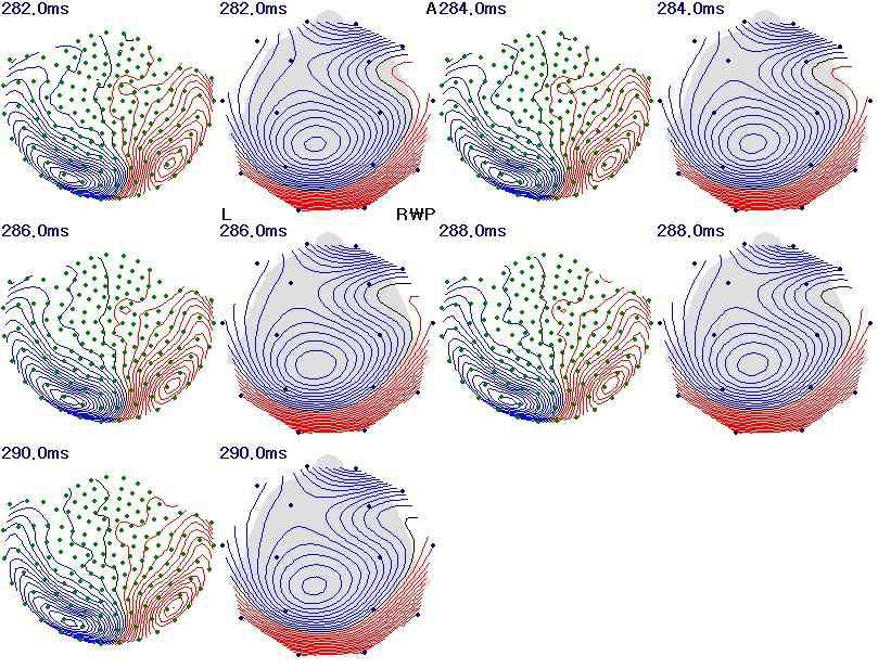 2D power map of MEG and EEG signals in M1 component.