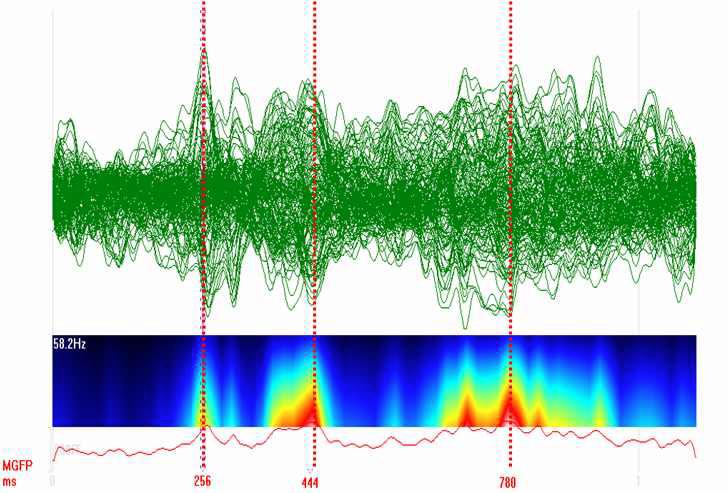 MEG butterfly plot and Spectra power(t) of ICH group