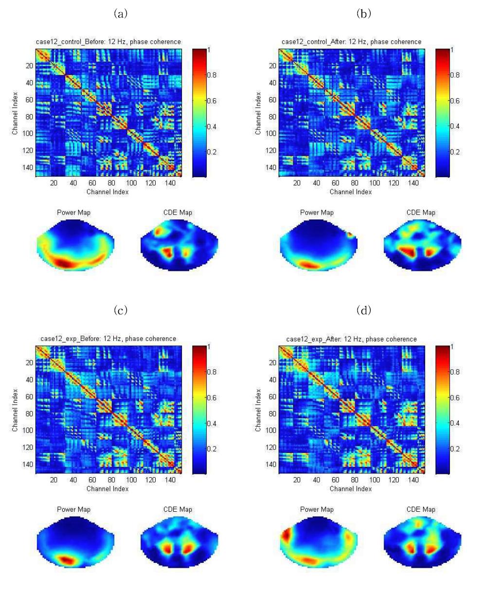 Mean phase coherence value and the power or coupling density estimated distribution map of the before(a) and after(b) of the control group, before(c) and after(d) of the experimental group (case12)