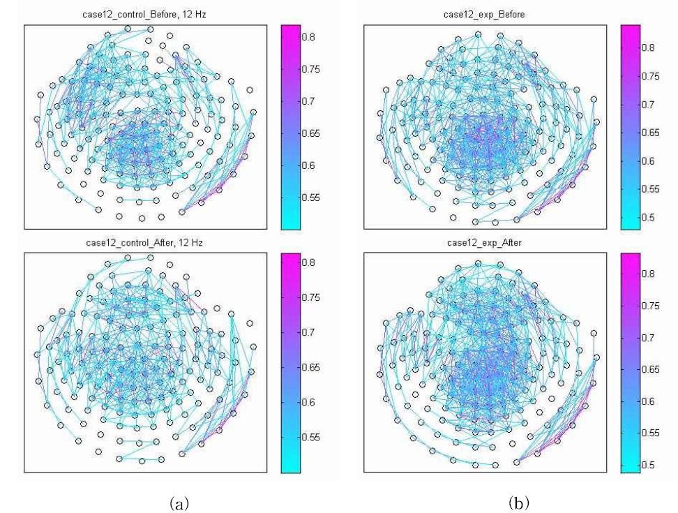 Coupling network between of the before(top) and after(bottom) of the control group(a) and the experimental group(b). (case12, MPC threshold = 0.5, minimum distance = 5 cm)