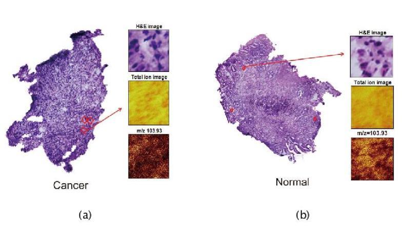 TOF-SIMS 분석용 생체조직 분석 준비 (a) Cancer 조직 H&E 이미지 (b) Normal 조직 H&E 이미지
