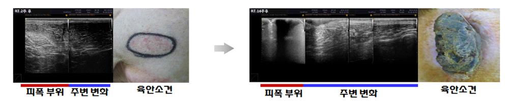 국소 피폭 후 육안변화 및 영상의학적 변화