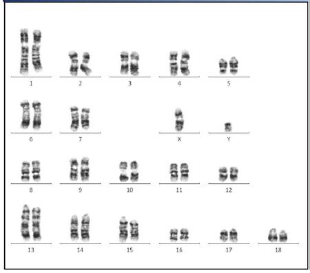 normal mini-pig karyotype(38,XY:GTG-banding)