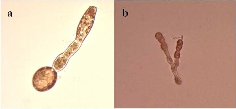 Arctic laminarian filaments (S. latissima (Linnaeus) C.E.Lane, C.Mayes, Druehl & G.W.Saunders)