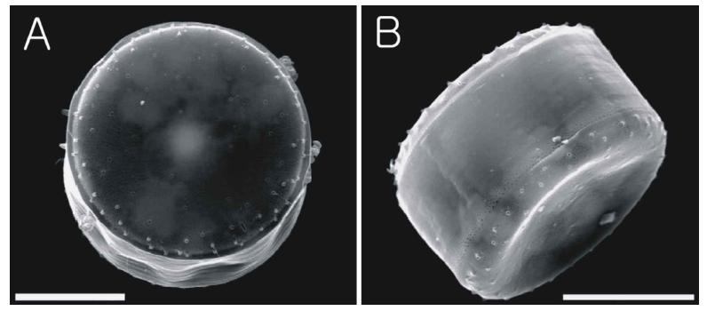 Scanning electron microscopy (SEM) of KOPRI AnM0008.