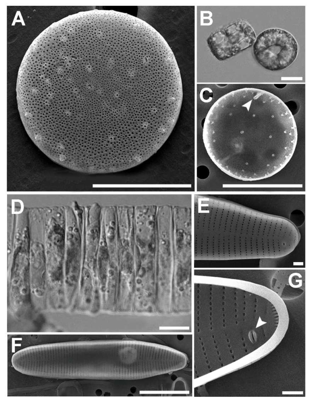 A - C, PorosirapseudodenticulataandD - G, Fragilariastriatula.Entire valve in A, SEM and B, LM (B); C, internal view with a single labiate process (arrow). D, ribbon colonies in LM; E, SEM valvar view; F, valve apex in external view; G, single labiate process (arrow) in internal view.