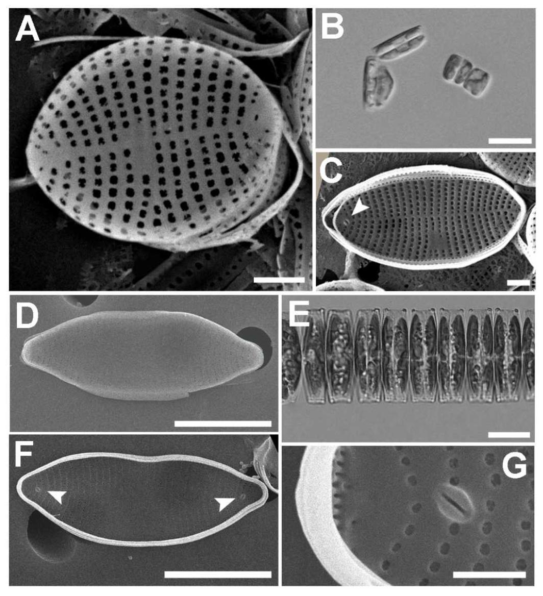 A - C,Fragilariasp.1;D - G,F.sp.2.A, SEM valvar view; B, colonies in LM; C, single labiate process (arrow) in internal view. D, SEM valvar view; E, ribbon colonies in LM; F, G, internal view with double labiate processes (arrows).