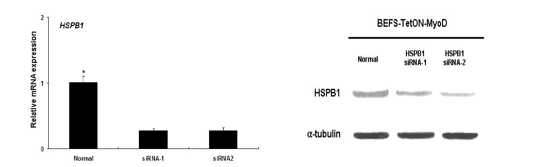 HSPB1 siRNA 처리시 BTM에 대한 HSPB1의 knockdown 효율 검증.