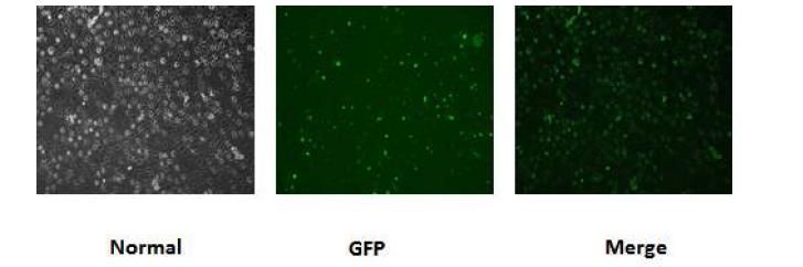 HSPB1 overexpression BEFS의 근육분화 유도한 후 6일 째 GFP 및 세포형태 확인