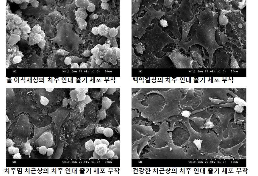 치근면에서 치주인대 줄기세포의 3D culture 결과