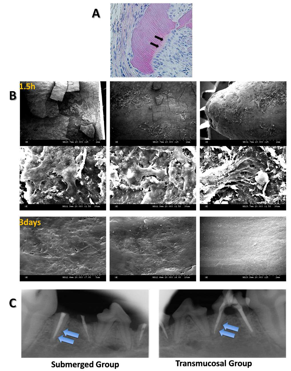 A. Fibronectin 처치에 의해 세포의 부착 및 분화가 향상 되었다. B. 3D culture에 의해 fibronectin coating 치근면으로 치주인대 줄기세포가 잘 부착되었고 C. 성견의 치아이식 모델에 이식되었을 때 PDL space가 재생된 것을 볼 수 있다.