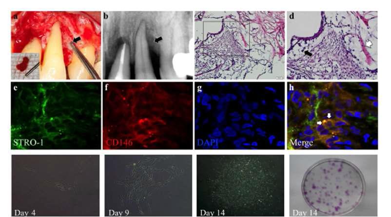 염증 치주 조직에서 줄기세포특성의 세포분리