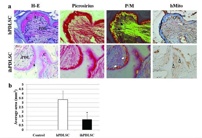 염증 치주조직에서 분리된 PDLSC의 in vivo ectopic periodontal tissue regeneration